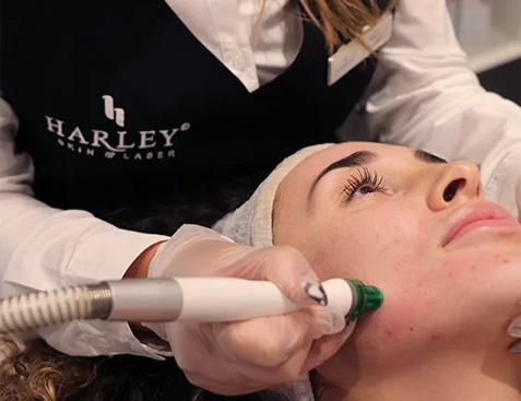 Hydradermabrasion treatment for anti-aging skin